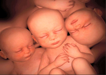 triplets