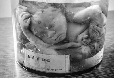 abortion