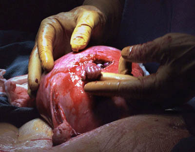 The Hand of Hope