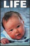 aborted fetus picture